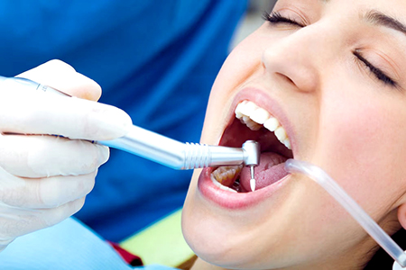 Teeth-Cleaning-&-Polishing-in-jalandhar-punjab